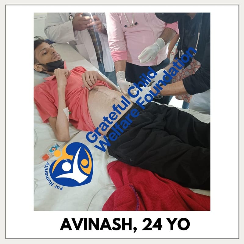 Avinash - Suffering from Tuberculosis and Live Infection
